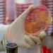 Researchers suggest how microorganisms respond to the disinfecting properties of silver nanoparticles Researchers suggest how microorganisms respond to the disinfecting properties of silver nanoparticles