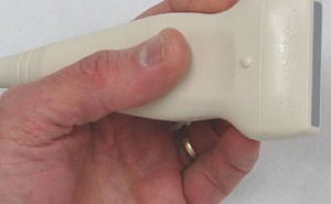 Options for difficult central venous cannulation insertion? ultrasound va
