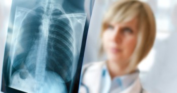 Septic pulmonary embolism related to implanted central venous access port picc tip