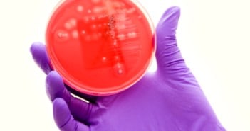 UK Sepsis Trust announce the Sepsis Unplugged 2016 conference CLABSI prevention