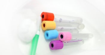 Phlebotomy test may detect cancer relapse phlebotomy
