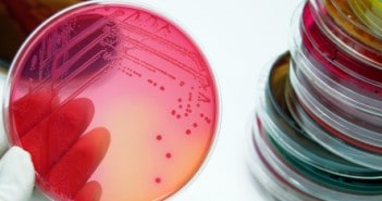 BD announce the launch of a new transparent IV dressing with CHG hai surveillance