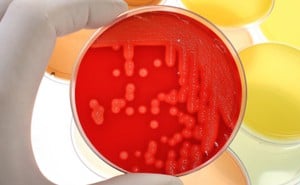 Prevalence of antiseptic tolerance genes among staphylococci and enterococci clabsi