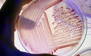 Cost analysis of haemodialysis catheter related bloodstream infection clabsi