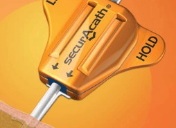 SecurAcath receives NICE recommendation: Highlights massive cost savings from improved catheter securement securacath