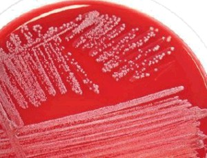 chlorhexidine–silver sulfadiazine-impregnated venous catheters