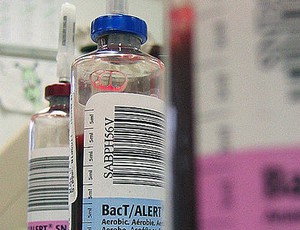 Are three blood cultures sets really necessary in febrile patients? 2 blood cultures