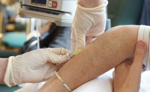 Implementation of a safe and effective intravenous iron infusion protocol to prevent skin staining intravenous dressings