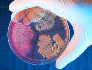 Efficacy of chlorhexidine patch on CLABSI in children 10 central line infection definition