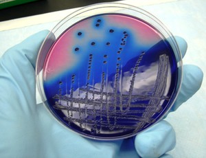 National intervention to prevent central line-associated bloodstream infection 1 chlorhexidine skin antisepsis
