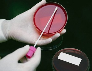 Impact of a simple hygiene insertion bundle on CLABSI rates 5 clabsi