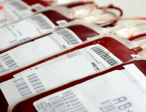 Double intraosseous access has the potential to augment resuscitation 30 simulation training in transfusion medicine