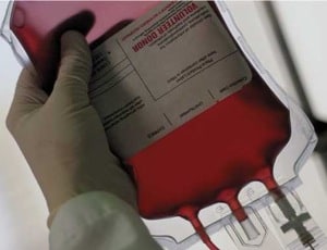 Does the use of an infusion pump for red blood cells increase hemolysis? 14 transfusion