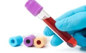 BD receives FDA 510(k) clearance for new blood collection device picc bloods