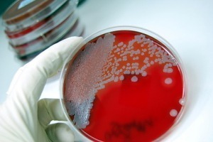 Vascular access-related infections in two haemodialysis units 7 clabsi