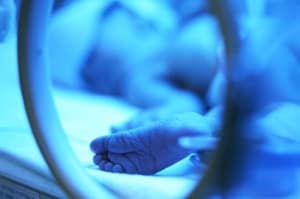 neonatal ultrasound