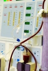 dialysis vascular access