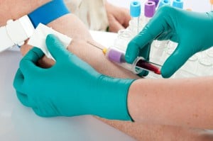 Lyme disease overdiagnosis in a large healthcare system 12 venipuncture