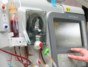 hemodialysis