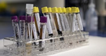 Administration of Vancomycin at high doses in patients with post neurosurgical meningitis
