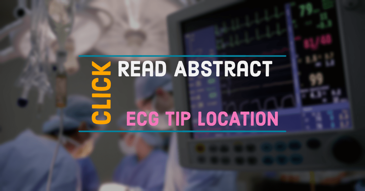 ECG assisted central venous access tip location 5 ECG